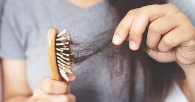 Cabelo fraco e quebradiço (Foto: Reprodução/ Internet)