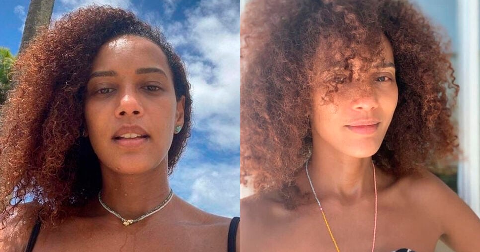 Pele de Taís Araújo (Foto: Reprodução - Instagram)