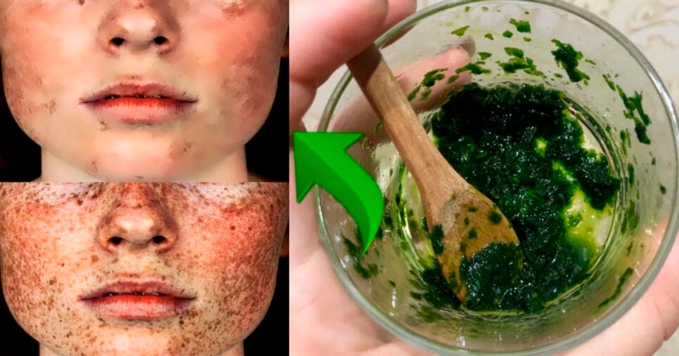 Receita de salsa para a pele (Foto: Reprodução)