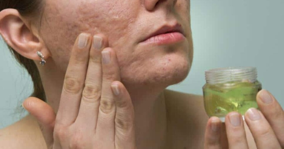 Esse produto combate as rugas e as manchas da idade (Foto: Divulgação)