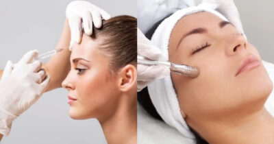 Receita para eliminar as rugas melhor que botox (Foto: Divulgação)