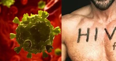 Famosos com HIV - Foto: Internet