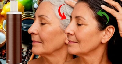 Ilustração de antes e depois de uma aplicação de método natural para cobrir brancos (Foto Reprodução/Montagem/Lennita/TV Foco/Canva/GMN)