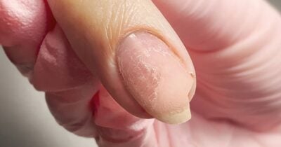 Unhas - Foto: Internet