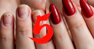 Unhas podem ficar ainda mais frágeis com esses 5 erros (Foto Reprodução/Montagem/TV Foco/Lennita/GMN/Canva)