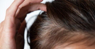 Cabelo branco nunca mais (Foto: Divulgação)