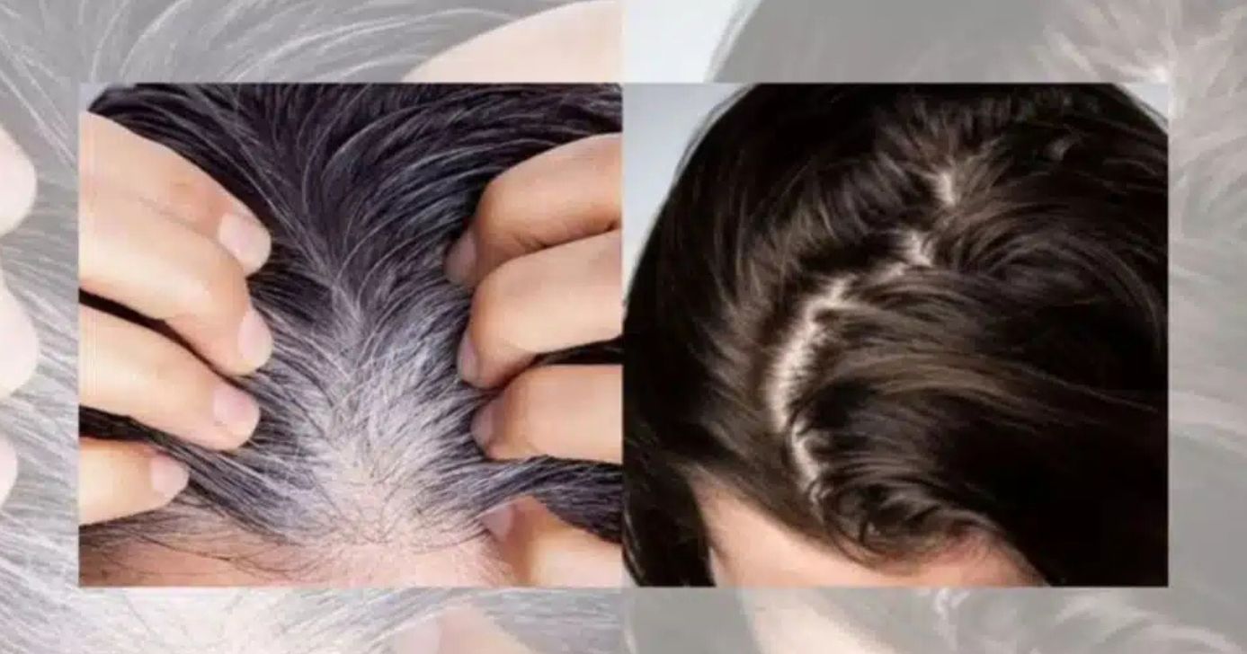Cabelo branco antes e depois - Foto: Ilustração