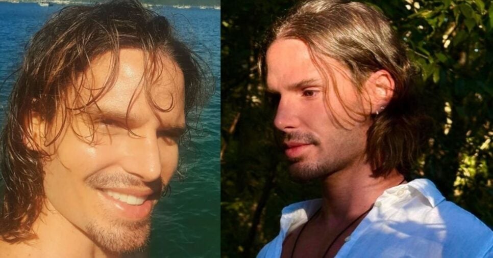 Jonatas Faro fez procedimento de harmonização facial (Foto Reprodução/Instagram @jonatasfaro)