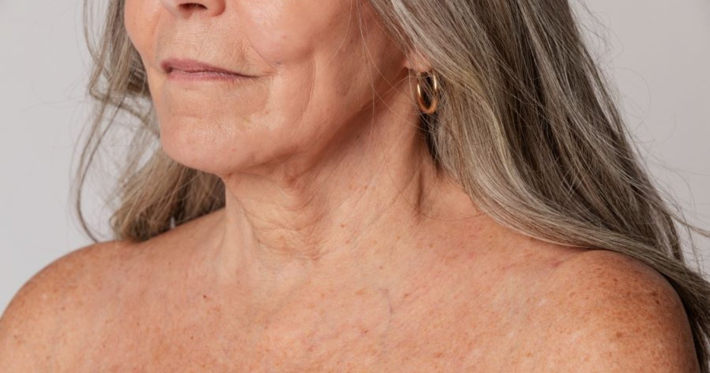 Hábitos que estão te causando rugas (Foto: Divulgação)