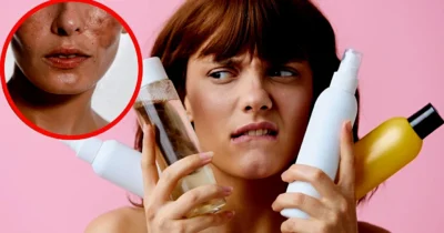 Erro comum na rotina de skincare dá efeito rebote (Foto Reprodução/Montagem/Lennita/Canva/Tv Foco)