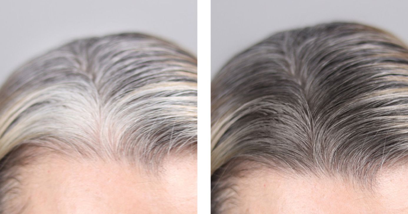 Antes e depois do cabelo branco - Foto: Ilustração/ Internet