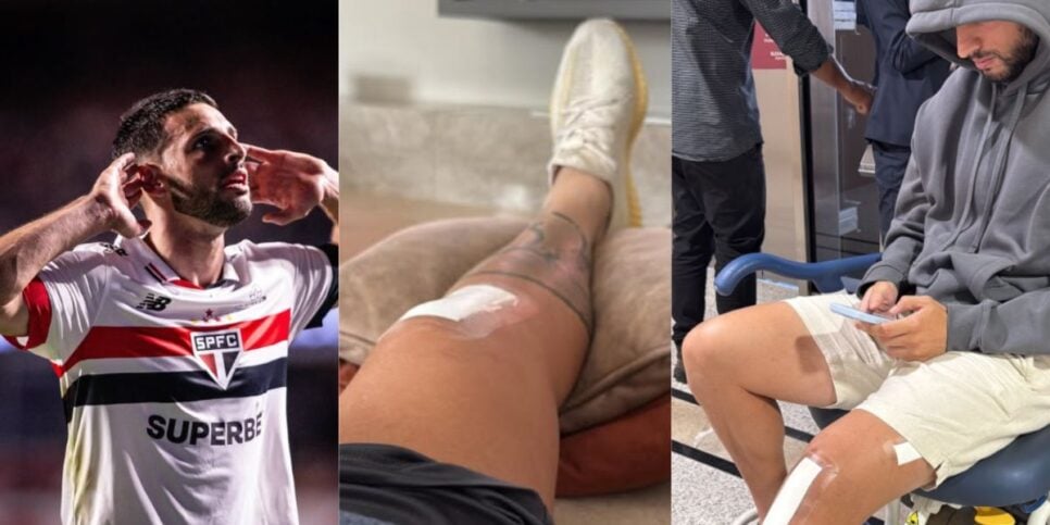 Calleri segueem recuperação da lesão (Reprodução: Instagram)