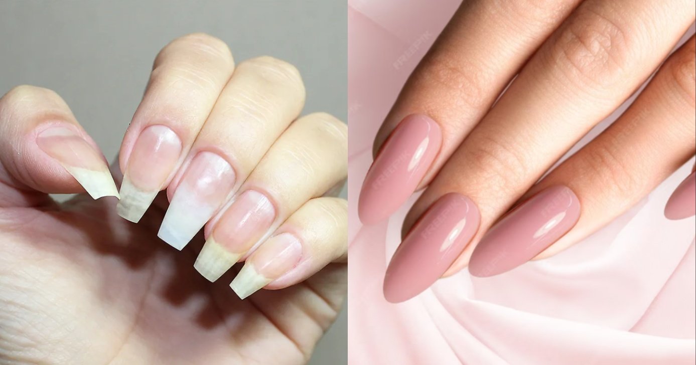 1 ingrediente deixa unhas gigantes e 4 cores para rejuvenescer (Foto: Reprodução/ Internet)