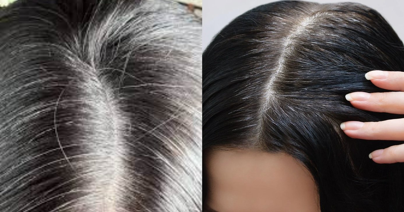 Como acabar com cabelo branco usando tônico (Foto: Divulgação)