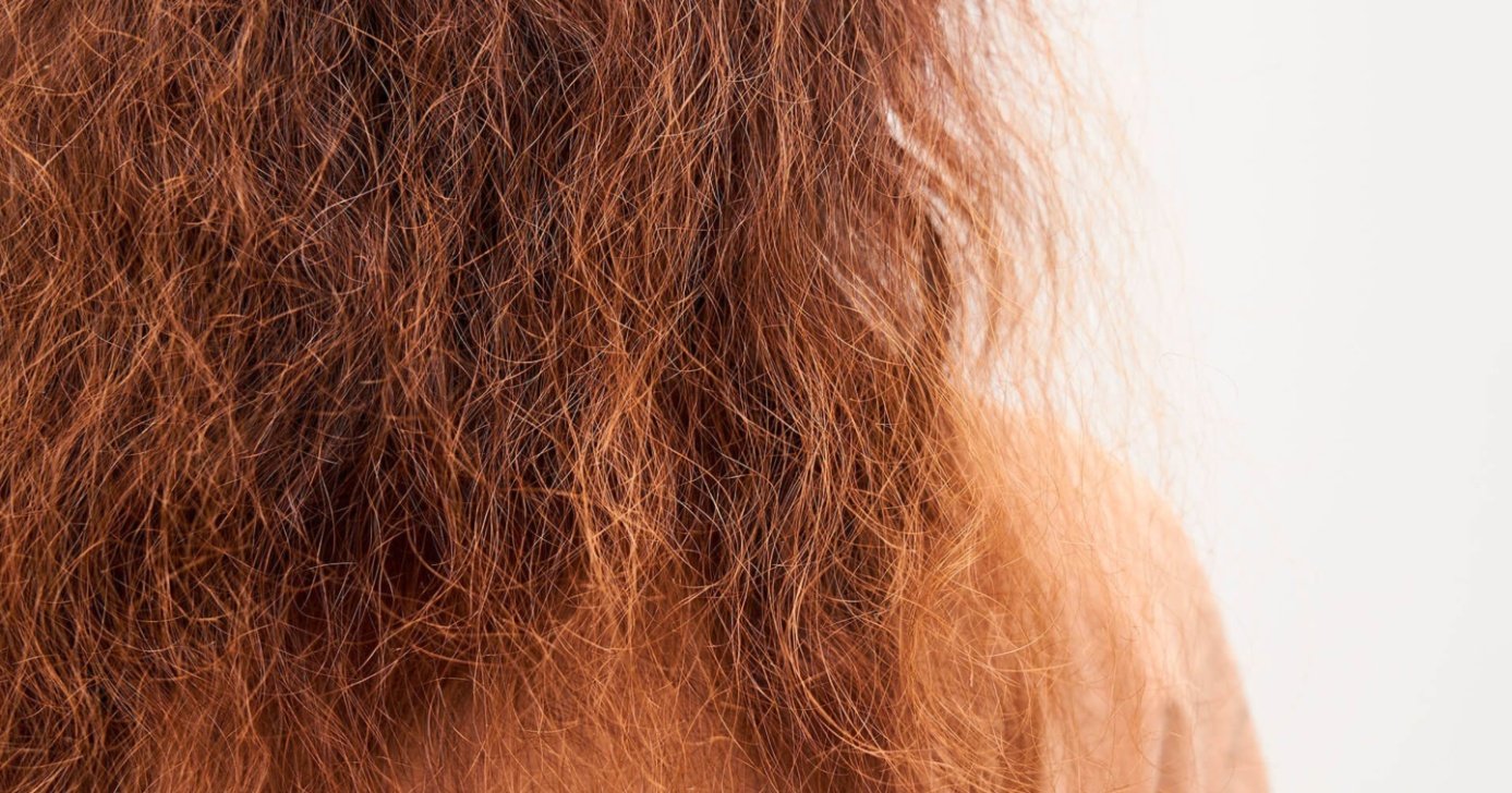 Cabelo seco e quebradiço (Foto: Reprodução/ Internet)