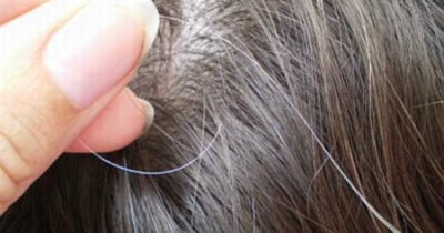 O que causa cabelos brancos antes da hora (Foto: Divulgação)