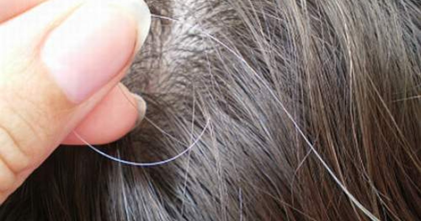 O que causa cabelos brancos antes da hora (Foto: Divulgação)