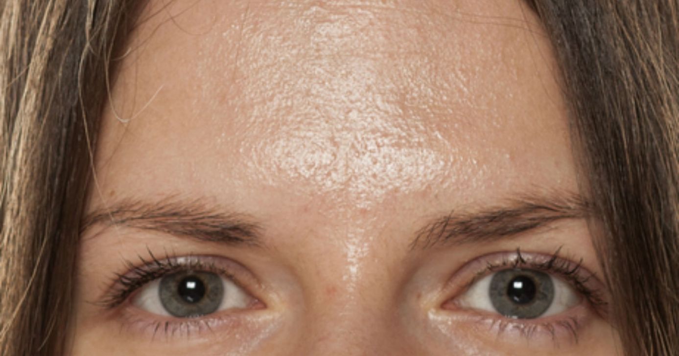 Mulher com a pele oleosa - Foto: Canva