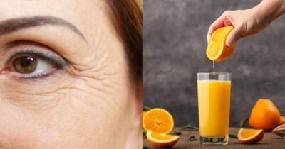 Rugas e suco de laranja (Foto: Reprodução/ Internet)