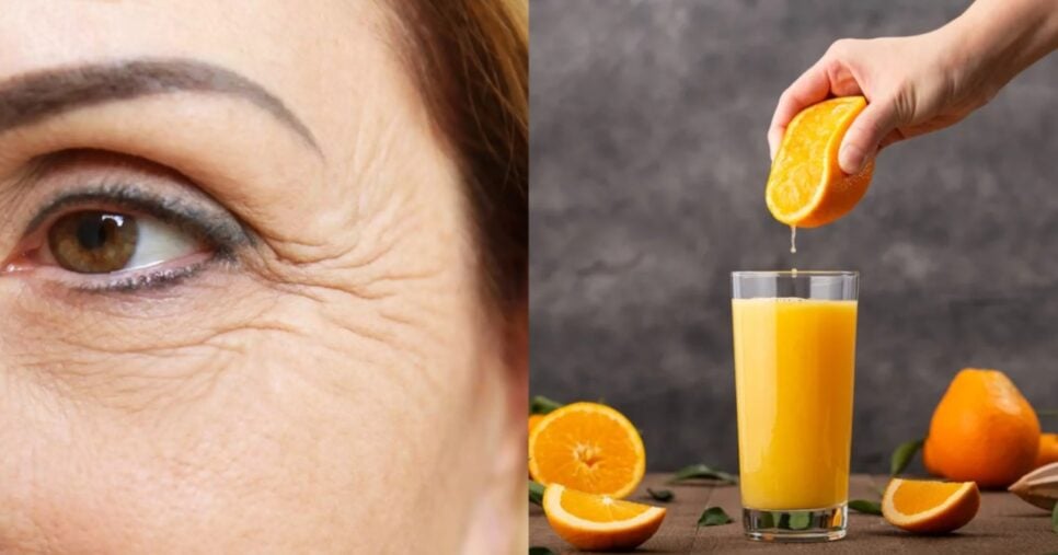 Rugas e suco de laranja (Foto: Reprodução/ Internet)