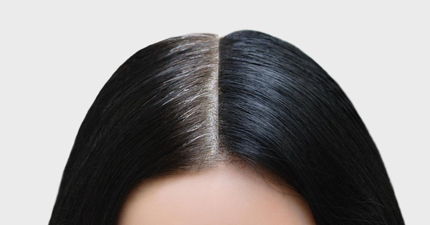 Cabelo branco antes e depois - Foto: Internet