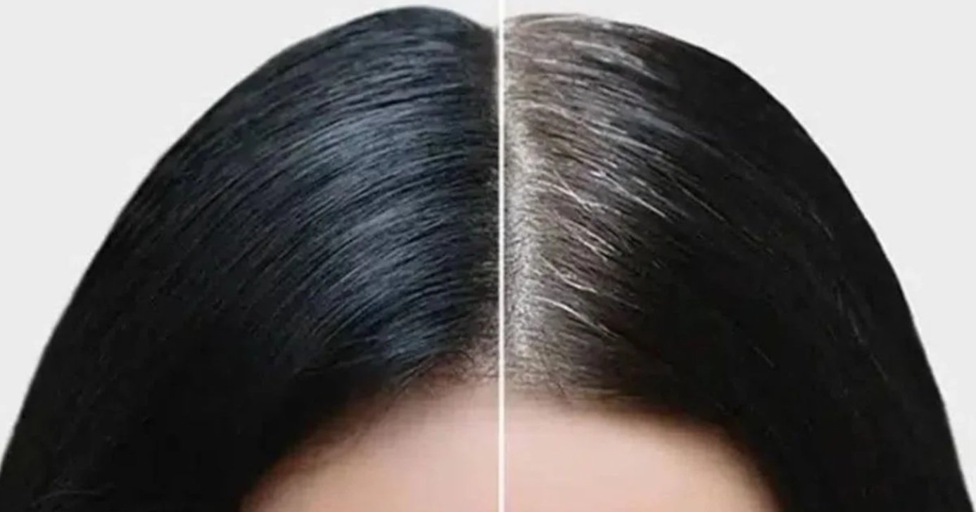 Cabelo branco antes e depois - Foto: Internet