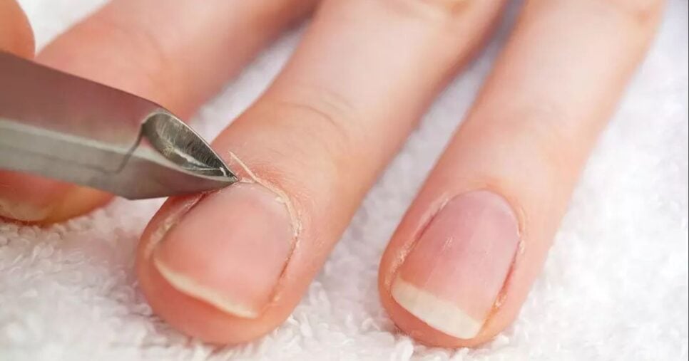 Cutículas unhas - Foto; Montagem