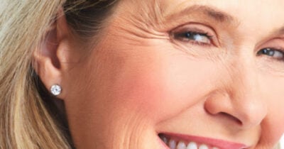 Como acabar com pé de galinha no rosto com colágeno caseiro (Foto: Divulgação)