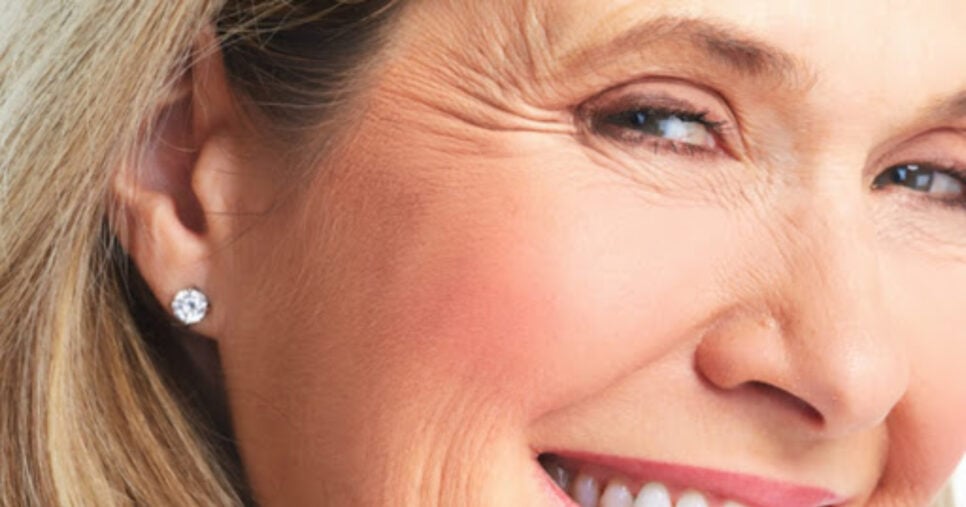 Como acabar com pé de galinha no rosto com colágeno caseiro (Foto: Divulgação)