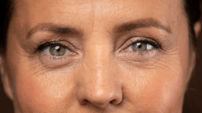 Pele com algumas rugas (Foto: Reprodução/ Freepik)