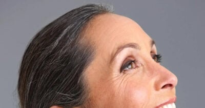 Os 3 ingredientes para combater as rugas (Foto: Divulgação)