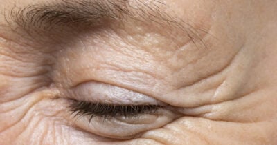 Amenize rugas com esse tônico (Foto: Divulgação)