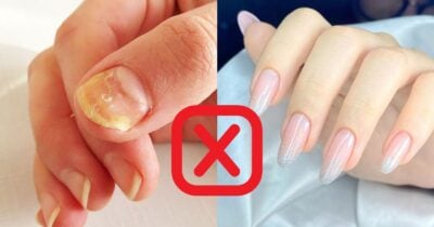 Truque caseiro devolve o brilho e deixa unhas gigantes - Foto: Montagem