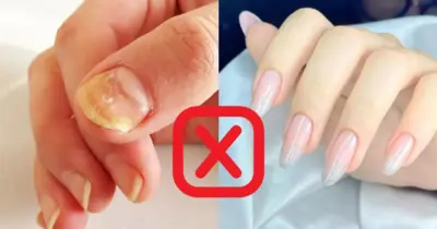 Fim do aspecto amarelo e quebras: Truque caseiro devolve o brilho e deixa unhas gigantes