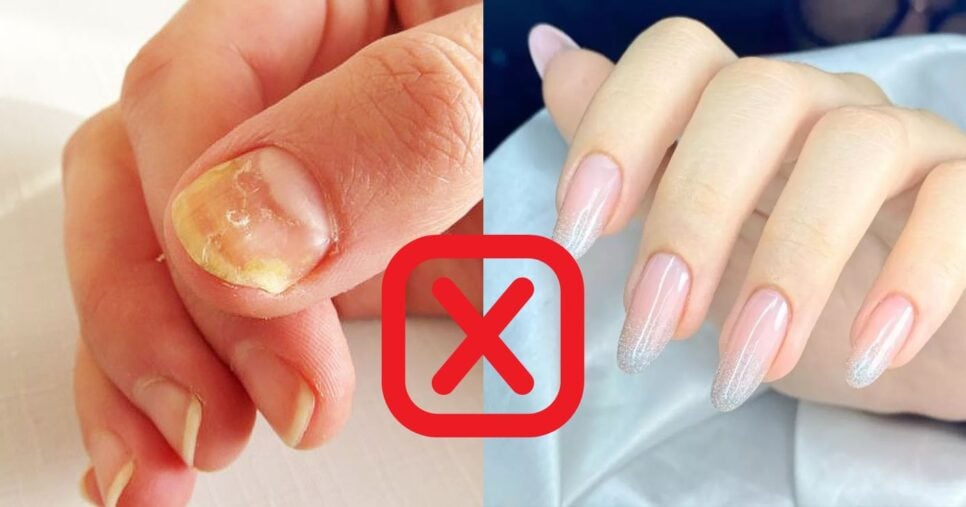 Truque caseiro devolve o brilho e deixa unhas gigantes - Foto: Montagem