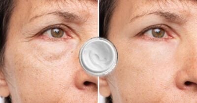 Adeus cremes de farmácia: descubra o único ingrediente que elimina rugas em minutos para as mulheres 50+ (Foto Reprodução/Montagem/TV Foco/Canva/Paola)