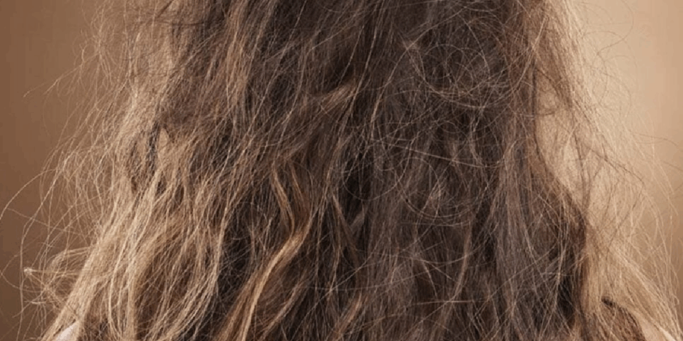 Cabelo com nó, frizz e pontas duplas (Foto: Reprodução/Internet)