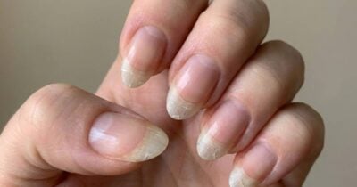 7 hábitos comuns que estão destruindo as unhas das mulheres (Foto: Montagem/TV Foco)