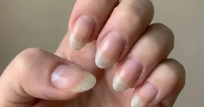 Nem manicure salva: 7 hábitos comuns que estão destruindo as unhas das mulheres