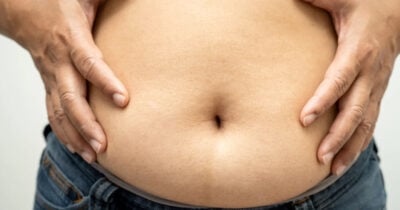 Oléo natural para acabar com inchaço de barriga (Foto: Divulgação)