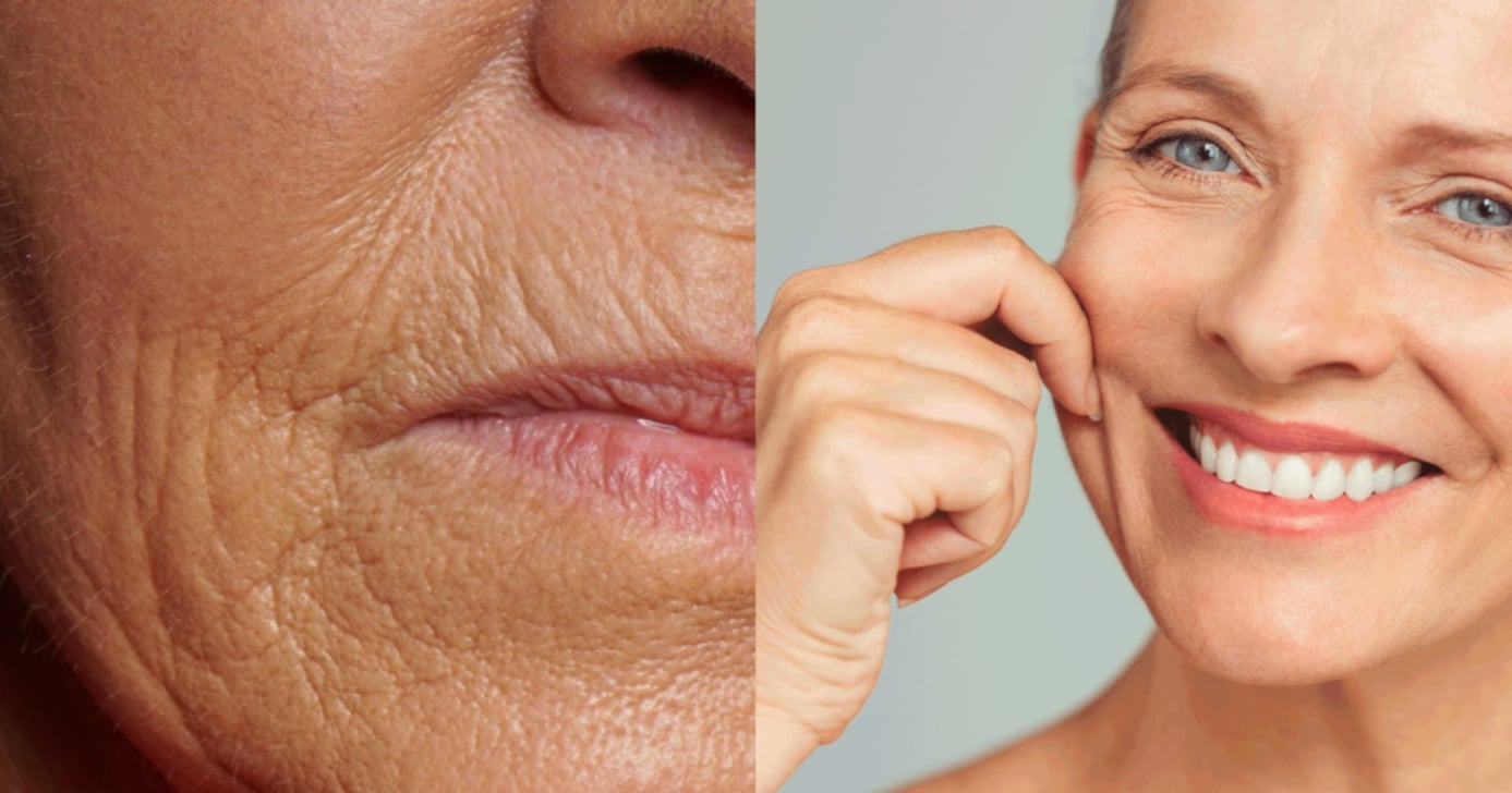 Fim do colágeno de farmácia: Receita natural dá fim às rugas (Foto: Reprodução/ Internet)