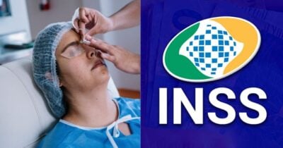 Ilustração cirurgia de catarata e logo do INSS (Fotos: Reproduções / Canva / Internet)