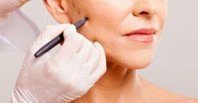 Lifting facial para ter explosão de colágeno (Foto: Divulgação)