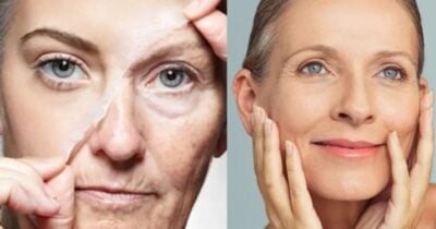 Harmonização facial caseira elimina rugas e linhas de expressão - Montagem/TV FOCO