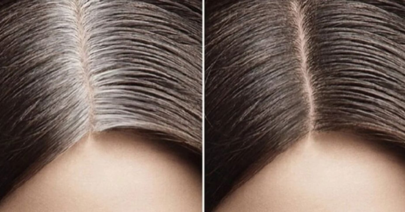 Cabelo branco Foto: Ilustração