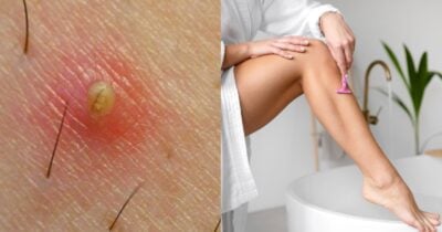 Óleo natural garante depilação rápida e sem irritação para o verão (Foto: Reprodução/ Internet)