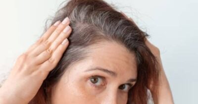 Cabelo branco - Foto: Ilustração/Internet