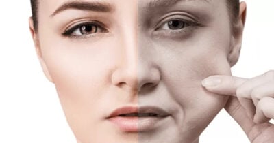 Principais motivos que estão deixando a pele flácida. (Foto: Divulgação)