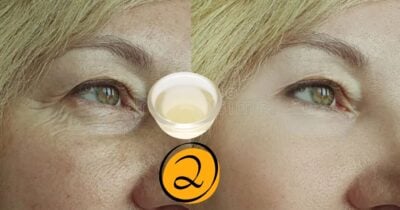 Fim do envelhecimento: Creme natural dispara colágeno e reduz rugas (Foto Reprodução/Montagem/TV Foco/Canva/Paola)