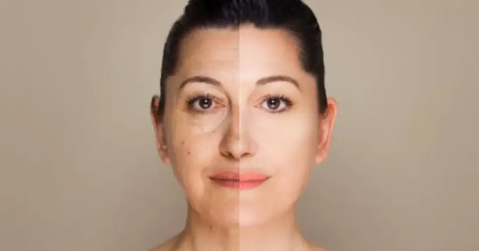 Como fazer solução com óleo natural para acabar com as rugas e manchas - Foto: Ilustração